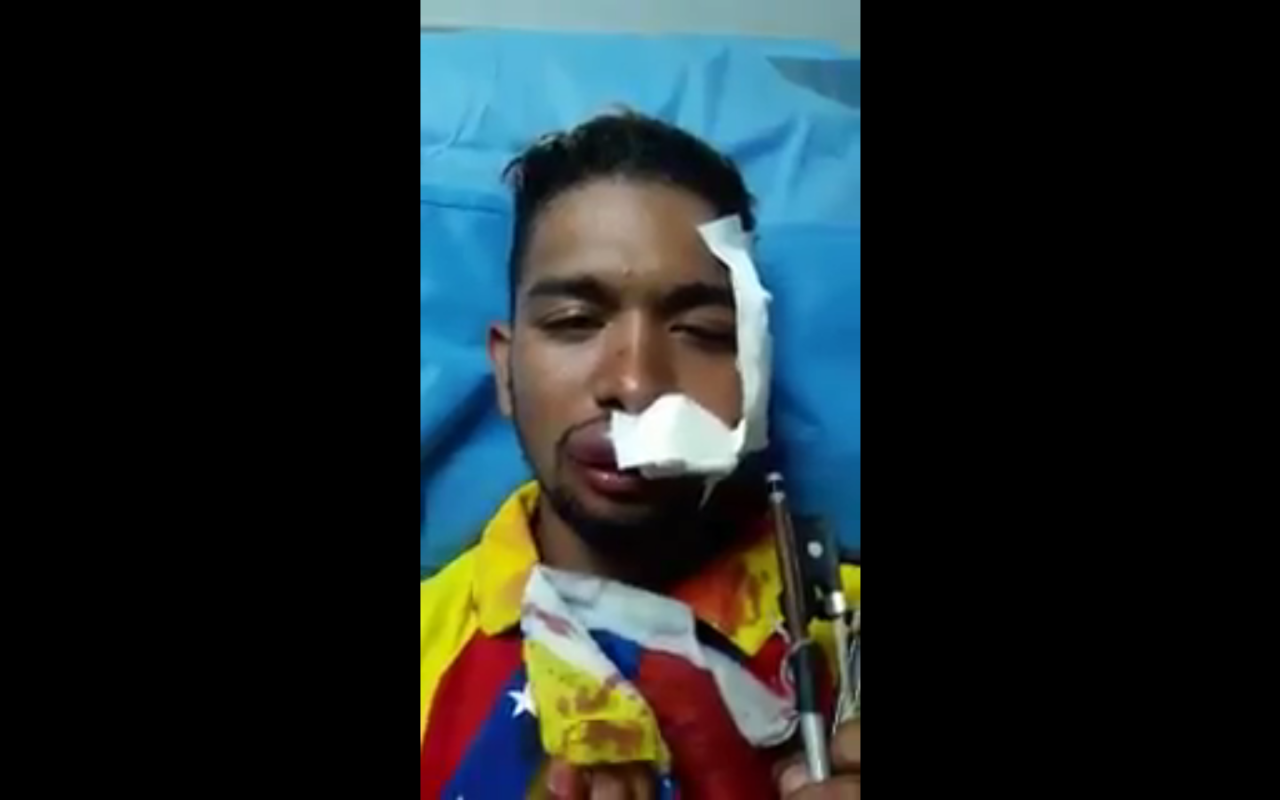 委國再爆衝突 示威代表人物小提琴家受傷