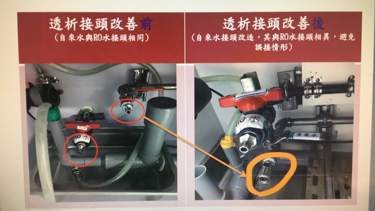 台大洗腎接錯管 衛福部修法要求通報