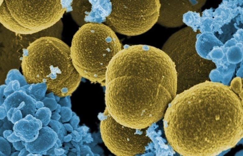 超級細菌增加 研究：2019年逾120萬人死於抗藥性感染
