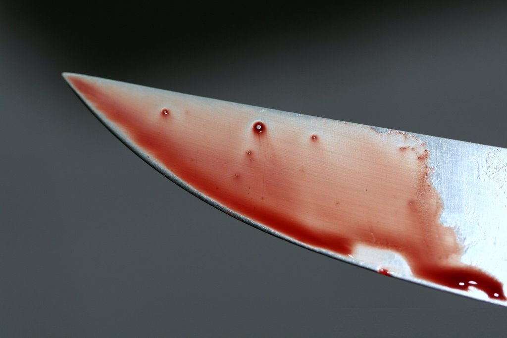 敢吃老娘豆腐 印度婦女切斷鄰居命根子