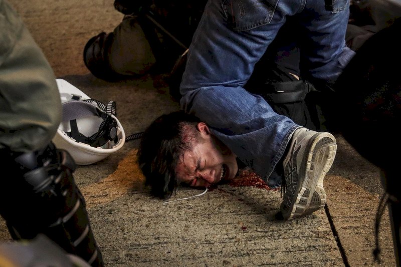 國際特赦：港警對示威者濫用暴力與酷刑
