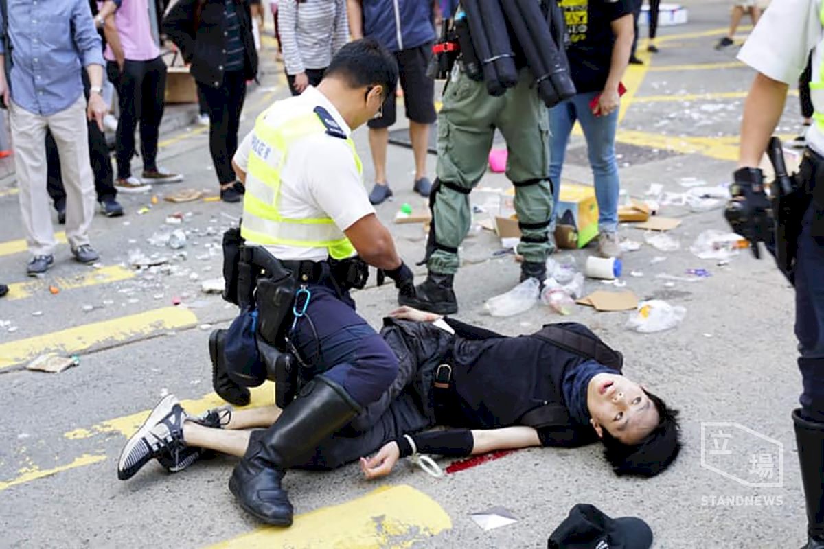 港街頭校園成戰場 中槍示威者切右腎