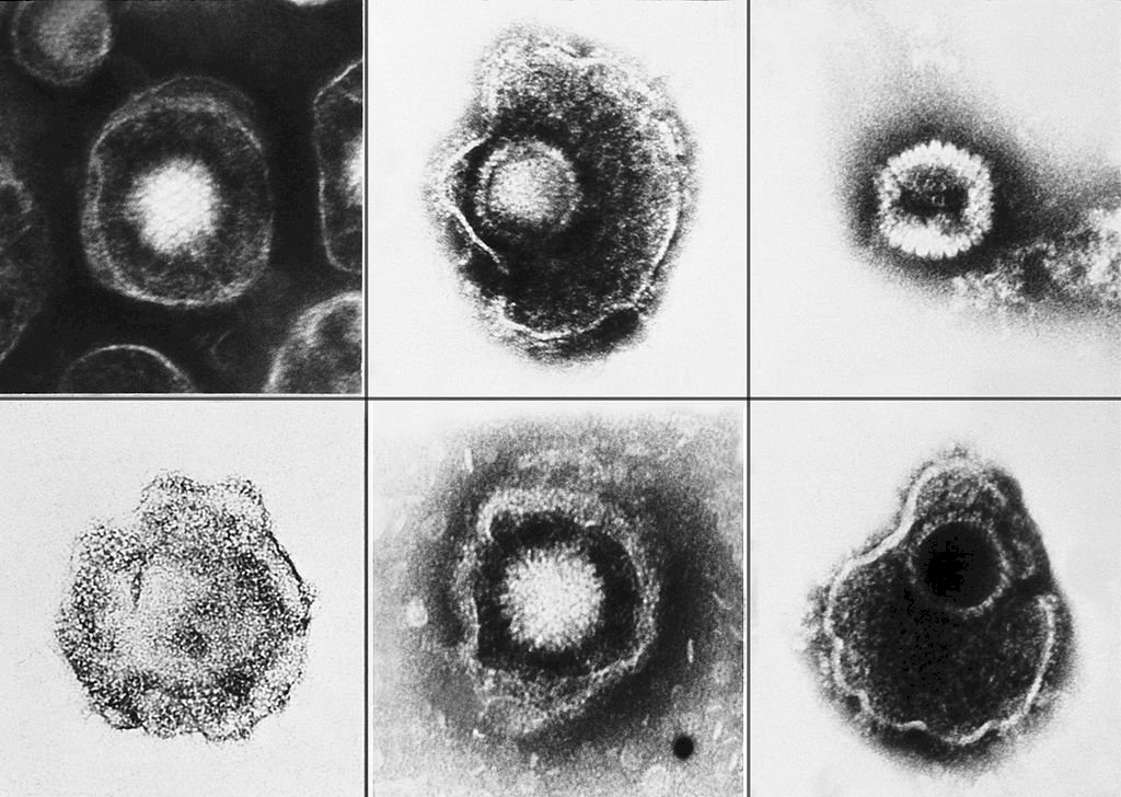 鹿兒島一人確診疱疹B病毒感染症 日本境內首例