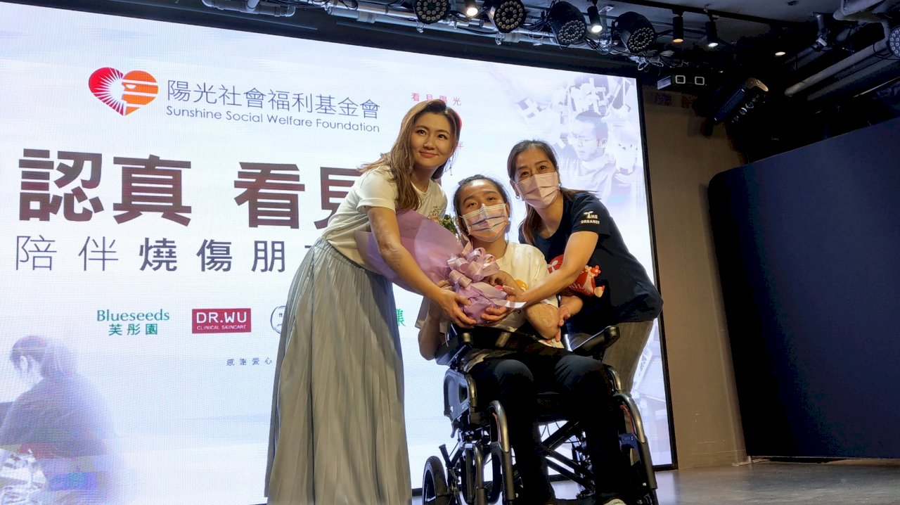 陽光基金會募款 Selina鼓勵燒傷病友絕不放棄(影音)