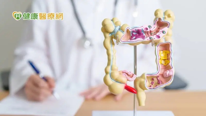 近9成大腸癌發生於「這年齡」！篩陽未做大腸鏡風險最高增64%